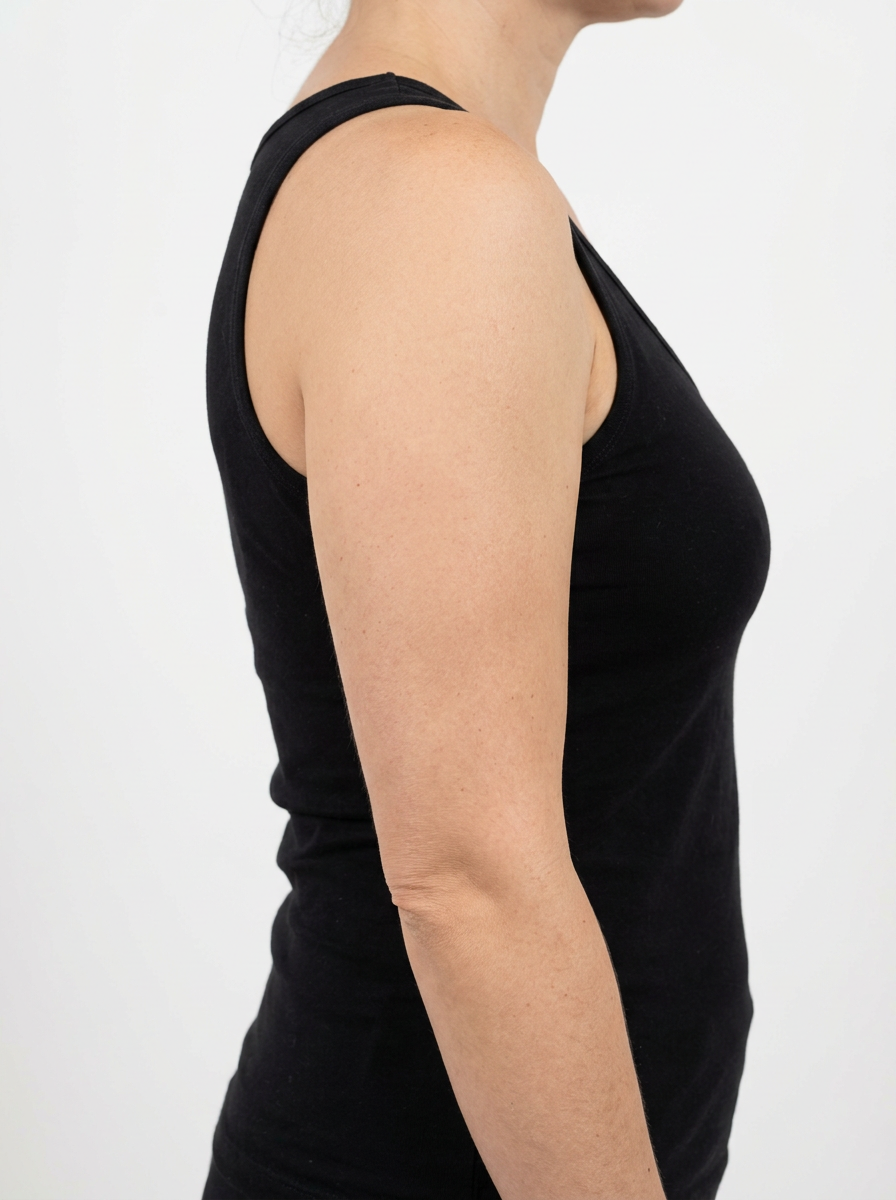 Before redSCULPT - Arms